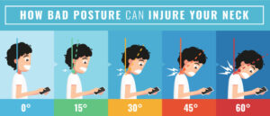 انزلاق الغضروف العنقي