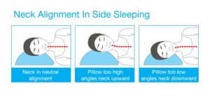 علاج شد عضلات الرقبة